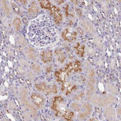 Immunohistochemistry-Paraffin: C12orf28 Antibody [NBP2-14374] - Staining of human kidney shows strong membranous positivity in subsets of renal tubules.