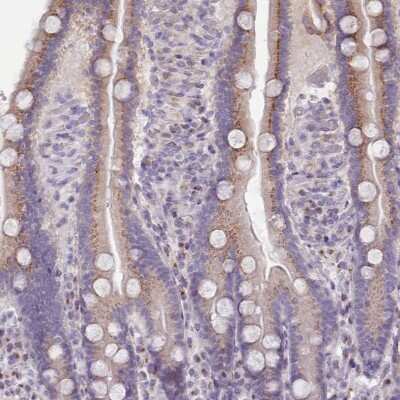 Immunohistochemistry-Paraffin: C12orf28 Antibody [NBP2-14374] - Staining of human duodenum shows moderate cytoplasmic positivity with a granular pattern in glandular cells.