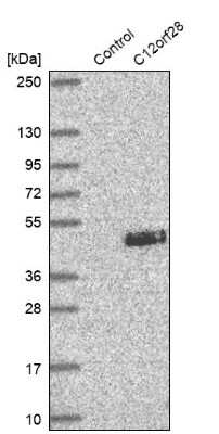 Western Blot: C12orf28 Antibody [NBP2-14374] - Analysis in control (vector only transfected HEK293T lysate) and C12orf28 over-expression lysate (Co-expressed with a C-terminal myc-DDK tag (3.1 kDa) in mammalian HEK293T cells).