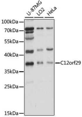 Western Blot: C12orf29 Antibody [NBP2-92281] - Analysis of extracts of various cell lines, using C12orf29 at 1000 dilution.Secondary antibody: HRP Goat Anti-Rabbit IgG (H+L) at 1:10000 dilution.Lysates/proteins: 25ug per lane.Blocking buffer: 3% nonfat dry milk in TBST.Detection: ECL Basic Kit .Exposure time: 10s.