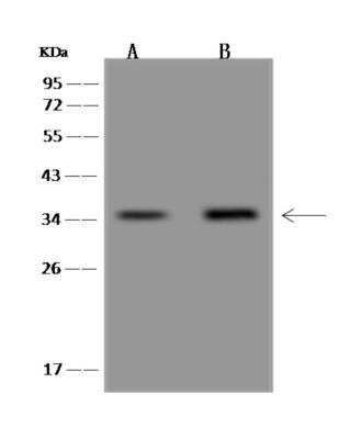 Western Blot: C12orf29 Antibody [NBP3-06161] - Anti-C12orf29 rabbit polyclonal antibody at 1:500 dilution Lane A: Hela Whole Cell Lysate Lane B: NCI-H460 Whole Cell Lysate Lysates/proteins at 30 ug per lane. Secondary: Goat Anti-Rabbit IgG (H+L) HRP  at 110000 dilution. Developed using the ECL technique. Performed under reducing conditions. Predicted band size: 37 kDa Observed band size: 34 kDa