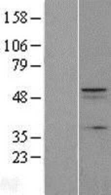 Western Blot: C12orf34 Overexpression Lysate (Adult Normal) [NBL1-08137] Left-Empty vector transfected control cell lysate (HEK293 cell lysate); Right -Over-expression Lysate for C12orf34.