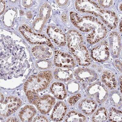 Immunohistochemistry-Paraffin: C12orf43 Antibody [NBP1-91713] - Staining of human kidney shows strong cytoplasmic positivity in cells in tubules.