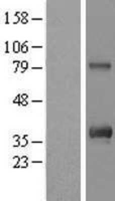 Western Blot: C12orf43 Overexpression Lysate (Adult Normal) [NBL1-08142] Left-Empty vector transfected control cell lysate (HEK293 cell lysate); Right -Over-expression Lysate for C12orf43.