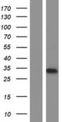 Western Blot: C12orf44 Overexpression Lysate (Adult Normal) [NBL1-08143] Left-Empty vector transfected control cell lysate (HEK293 cell lysate); Right -Over-expression Lysate for C12orf44.