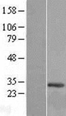 Western Blot C12orf45 Overexpression Lysate