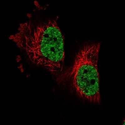 Immunocytochemistry/Immunofluorescence: PARPBP Antibody [NBP1-93969] - Staining of human cell line U-251 MG shows localization to nucleoplasm. Antibody staining is shown in green.