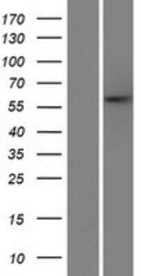 Western Blot: C12orf48 Overexpression Lysate (Adult Normal) [NBP2-06899] Left-Empty vector transfected control cell lysate (HEK293 cell lysate); Right -Over-expression Lysate for C12orf48.