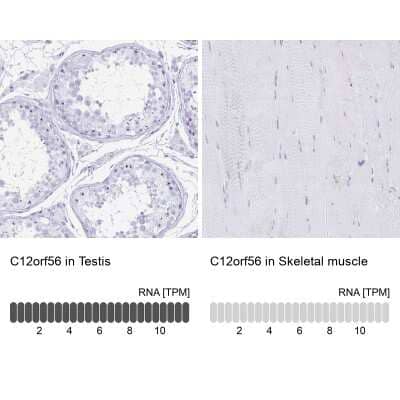 Immunohistochemistry-Paraffin C12orf56 Antibody - BSA Free