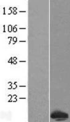 Western Blot: C12orf62 Overexpression Lysate (Adult Normal) [NBL1-08155] Left-Empty vector transfected control cell lysate (HEK293 cell lysate); Right -Over-expression Lysate for C12orf62.