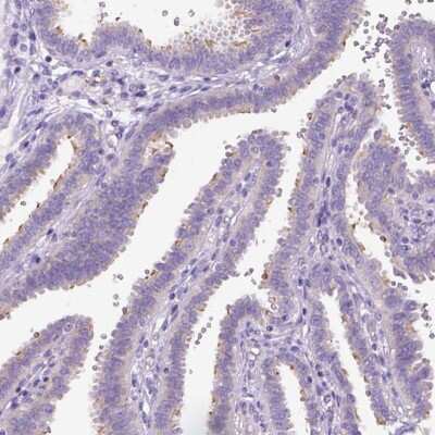 Immunohistochemistry-Paraffin: CFAP54 Antibody [NBP1-90737] - Staining of human fallopian tube shows moderate positivity in cilia of glandular cells.
