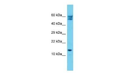 Western Blot: C12orf65 Antibody [NBP2-84538] - Host: Rabbit. Target Name: C12orf65. Sample Type: Jurkat Whole Cell lysates. Antibody Dilution: 1.0ug/ml
