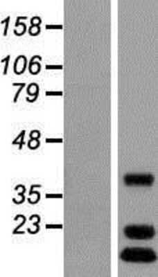 Western Blot: C12orf65 Overexpression Lysate (Adult Normal) [NBP2-09697] Left-Empty vector transfected control cell lysate (HEK293 cell lysate); Right -Over-expression Lysate for C12orf65.
