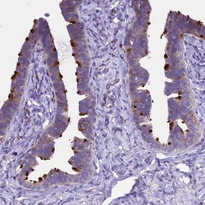 Immunohistochemistry-Paraffin: C12orf66 Antibody [NBP2-30447] - Staining of human fallopian tube shows moderate cytoplasmic positivity in glandular cells, as well as strong positivity in cilia.