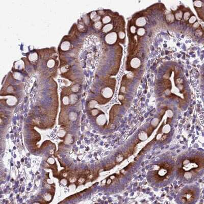 Immunohistochemistry-Paraffin: C12orf66 Antibody [NBP2-30447] - Staining of human small intestine shows strong cytoplasmic positivity in glandular cells.
