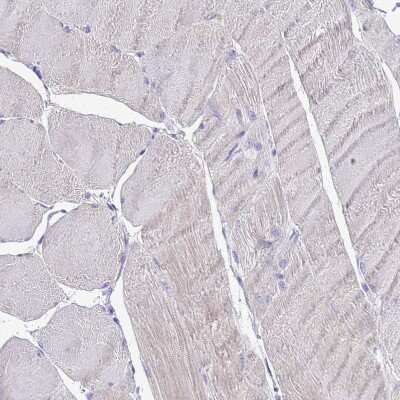 Immunohistochemistry-Paraffin: C12orf66 Antibody [NBP2-30447] - Staining of human skeletal muscle shows no positivity in myocytes as expected.