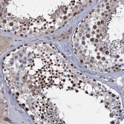 Immunohistochemistry: C12orf68 Antibody [NBP2-48717] - Staining of human testis shows strong nuclear positivity in ells of seminiferus ducts.