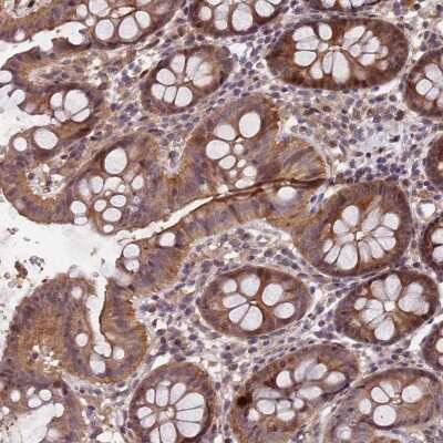 Immunohistochemistry-Paraffin: C12orf68 Antibody [NBP2-48747] - Staining of human colon shows moderate cytoplasmic, membranous and nuclear positivity in glandular cells.