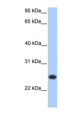 Western Blot: C12orf68 Antibody [NBP1-70432] - Titration: 0.2-1 ug/ml Positive Control: Human Muscle.