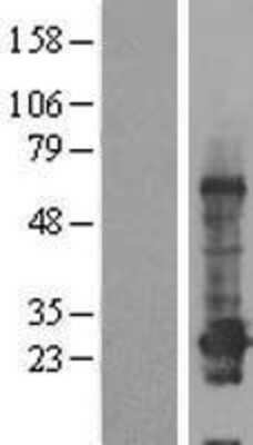 Western Blot: C12orf68 Overexpression Lysate (Adult Normal) [NBP2-08724] Left-Empty vector transfected control cell lysate (HEK293 cell lysate); Right -Over-expression Lysate for C12orf68.