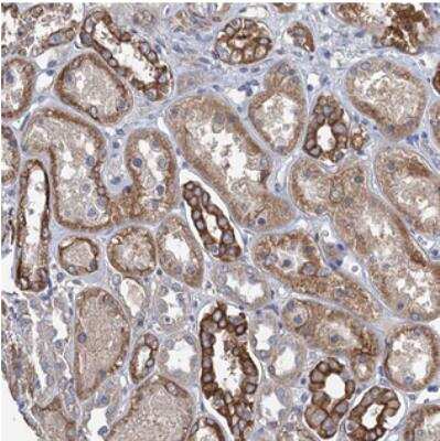 Immunohistochemistry: C12orf69 Antibody [NBP2-30445] - Staining of human kidney shows strong cytoplasmic positivity in renal tubules.