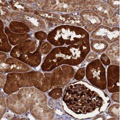 Immunohistochemistry: C12orf69 Antibody [NBP2-30513] - Staining of human kidney shows strong cytoplasmic positivity in cells in tubules and glomeruli.