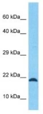 Western Blot: C12orf74 Antibody [NBP3-10752] - Western blot analysis of C12orf74 in COLO205 Whole Cell lysates. Antibody dilution at 1.0ug/ml