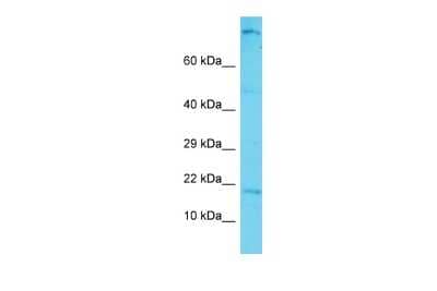 Western Blot: C12orf74 Antibody [NBP3-10753] - Western blot analysis of C12orf74 in Hela Whole cell lysates. Antibody dilution at 1.0ug/ml