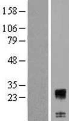 Western Blot: C12orf74 Overexpression Lysate (Adult Normal) [NBP2-08556] Left-Empty vector transfected control cell lysate (HEK293 cell lysate); Right -Over-expression Lysate for C12orf74.