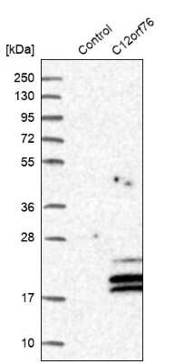 Western Blot: C12orf76 Antibody [NBP2-48714] - Analysis in control (vector only transfected HEK293T lysate) and C12orf76 over-expression lysate (Co-expressed with a C-terminal myc-DDK tag (3.1 kDa) in mammalian HEK293T cells).