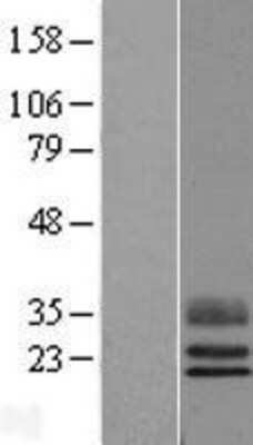 Western Blot: C13orf16 Overexpression Lysate (Adult Normal) [NBL1-08158] Left-Empty vector transfected control cell lysate (HEK293 cell lysate); Right -Over-expression Lysate for C13orf16.