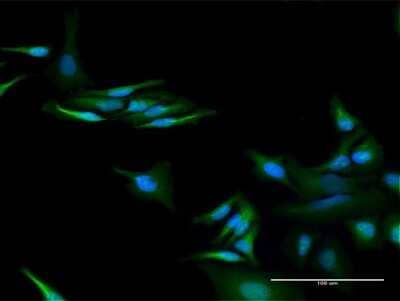 Immunocytochemistry/Immunofluorescence: C13orf18 Antibody [H00080183-D01P] - Analysis of antibody to C13orf18 on HeLa cell. Antibody concentration 20 ug/ml.