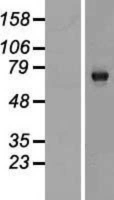 Western Blot: C13orf18 Overexpression Lysate (Adult Normal) [NBP2-06240] Left-Empty vector transfected control cell lysate (HEK293 cell lysate); Right -Over-expression Lysate for C13orf18.