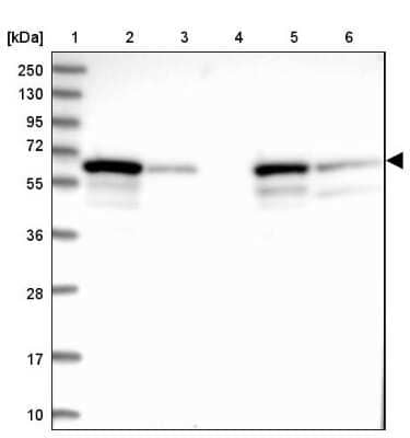 Western Blot: DGLUCY Antibody [NBP1-81920] -  Lane 1: Marker  [kDa] 250, 130, 95, 72, 55, 36, 28, 17, 10.  Lane 2: Human cell line RT-4.  Lane 3: Human cell line U-251MG sp.  Lane 4: Human plasma (IgG/HSA depleted).  Lane 5: Human liver tissue.  Lane 6: Human tonsil tissue