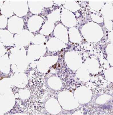 Immunohistochemistry: C14orf164 Antibody [NBP2-31000] - Staining of human bone marrow shows strong cytoplasmic positivity in hematopoietic cells.