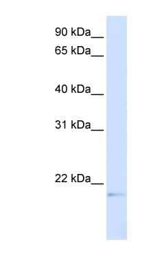 Western Blot: C14orf180 Antibody [NBP1-59522] - Transfected 293T cell lysate, concentration 0.2-1 ug/ml.