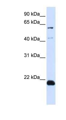 Western Blot: C14orf180 Antibody [NBP1-59680] - Transfected 293T cell lysate, concentration 0.2-1 ug/ml.