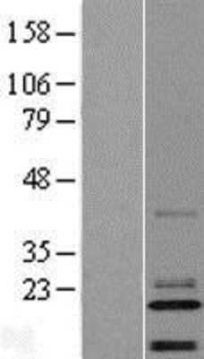 Western Blot: C14orf180 Overexpression Lysate (Adult Normal) [NBL1-08187] Left-Empty vector transfected control cell lysate (HEK293 cell lysate); Right -Over-expression Lysate for C14orf180.