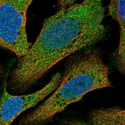 Immunocytochemistry/Immunofluorescence: C14orf28 Antibody [NBP2-55944] - Staining of human cell line U-2 OS shows localization to cytosol.