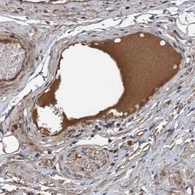 Immunohistochemistry-Paraffin TEDC1 Antibody - BSA Free