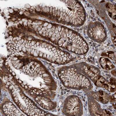 Immunohistochemistry-Paraffin: C14orf80 Antibody [NBP1-85864] - Staining of human stomach shows strong cytoplasmic positivity in glandular cells.