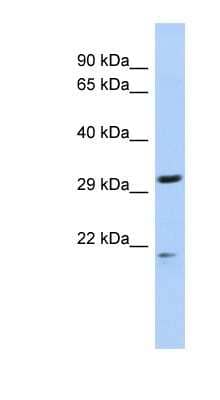 Western Blot: C14orf80 Antibody [NBP1-70436] - Jurkat cell lysate, concentration 0.2-1 ug/ml.