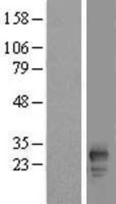 Western Blot FAM219B Overexpression Lysate