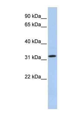 Western Blot: C15orf26 Antibody [NBP1-70437] - 721_B cell lysate, concentration 0.2-1 ug/ml.