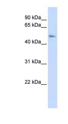 Western Blot: C15orf27 Antibody [NBP1-79519] - Titration: 0.2-1 ug/ml, Positive Control: 293T cell lysate.