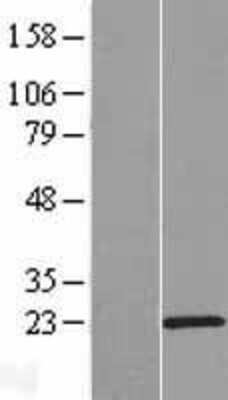 Western Blot: C15orf32 Overexpression Lysate (Adult Normal) [NBP2-05282] Left-Empty vector transfected control cell lysate (HEK293 cell lysate); Right -Over-expression Lysate for C15orf32.