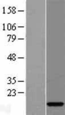 Western Blot: C15orf40 Overexpression Lysate (Adult Normal) [NBL1-08204] Left-Empty vector transfected control cell lysate (HEK293 cell lysate); Right -Over-expression Lysate for C15orf40.
