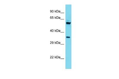 Western Blot: C15orf41 Antibody [NBP2-82842] - Host: Rabbit. Target Name: C15orf41. Sample Type: HepG2 Whole Cell lysates. Antibody Dilution: 1.0ug/ml