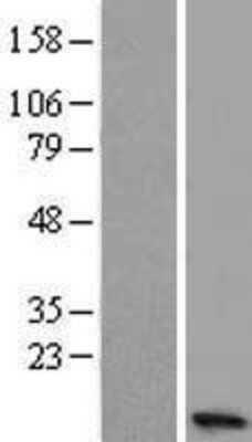 Western Blot: C15orf48 Overexpression Lysate (Adult Normal) [NBL1-08207] Left-Empty vector transfected control cell lysate (HEK293 cell lysate); Right -Over-expression Lysate for C15orf48.