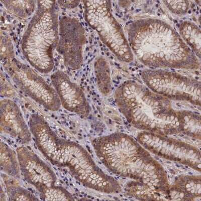 Immunohistochemistry-Paraffin: CCDC9B Antibody [NBP1-93763] - Staining of human stomach, upper shows moderate cytoplasmic positivity in glandular cells.